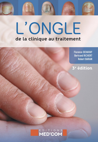 L'ongle