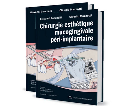 Chirurgie esthétique mucogingivale péri-implantaire - Pack 2 volumes