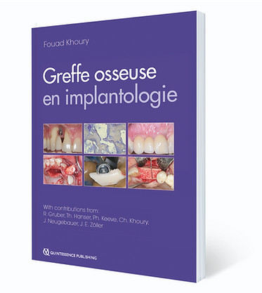 Greffe osseuse en implantologie