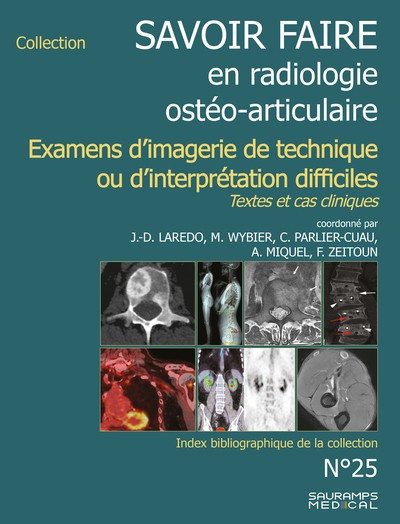 Savoir faire en radiologie ostéo-articulaire n°25