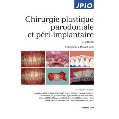 Chirurgie plastique...