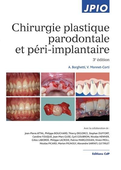 Chirurgie plastique parodontale et péri-implantaire