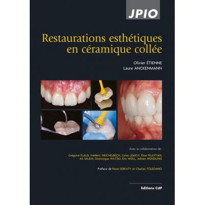 Restaurations esthétiques...
