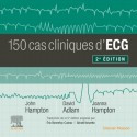 150 cas cliniques d\'ECG