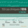 150 cas cliniques d'ECG