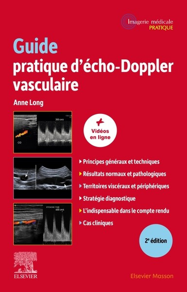 Guide pratique d'écho-doppler vasculaire