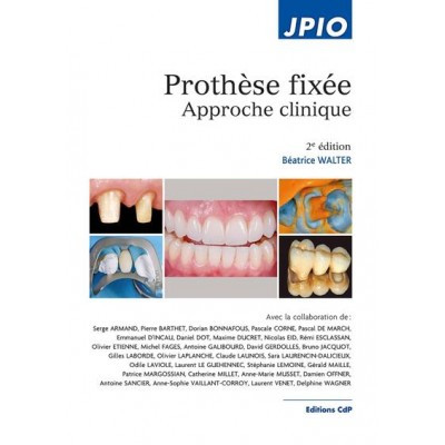 Prothèse fixée