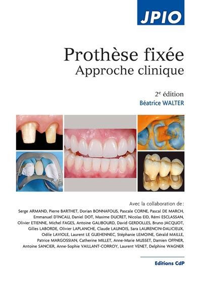 Prothèse fixée