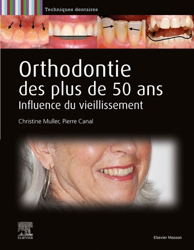 Orthodontie des plus de 50 ans