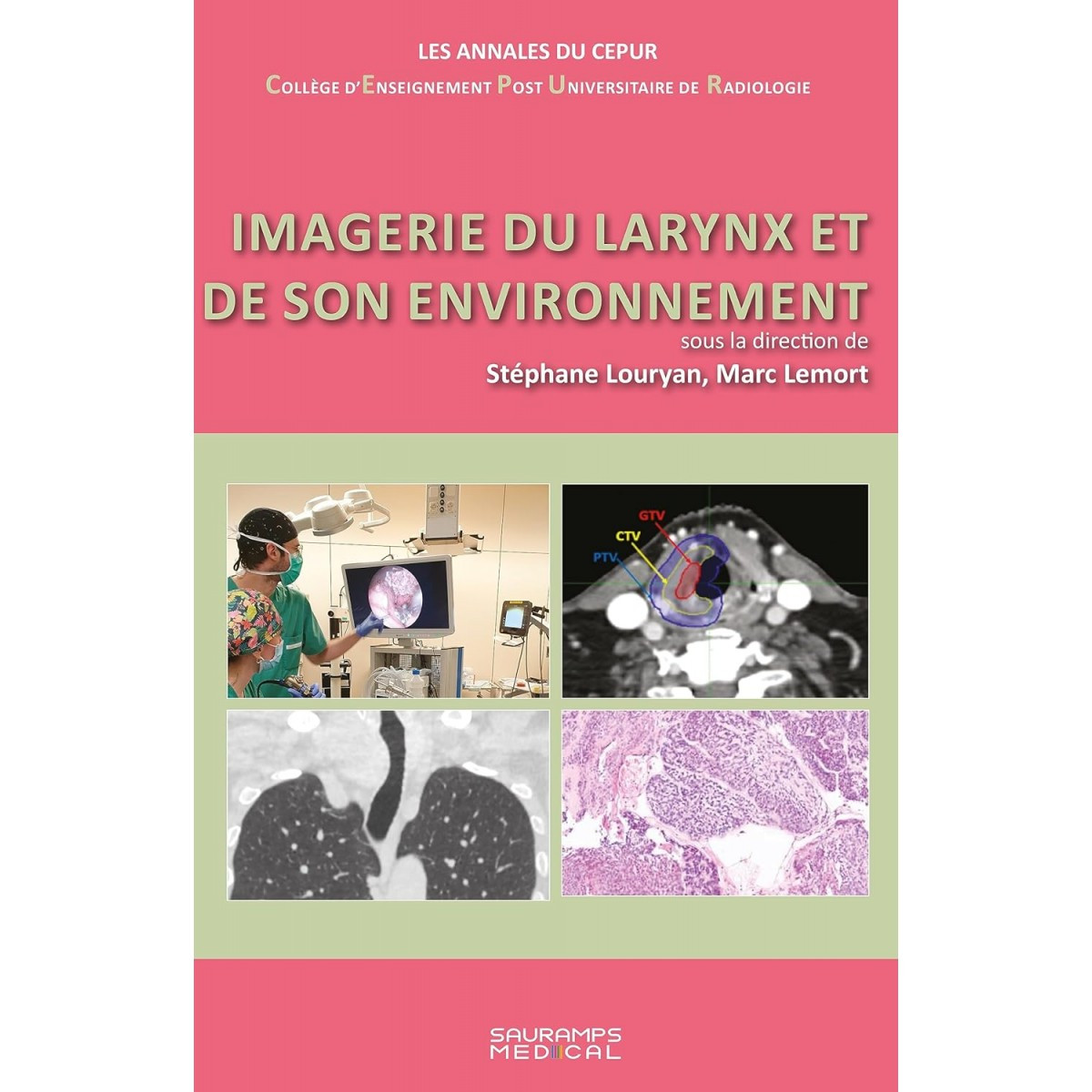 Imagerie du larynx et de son environnement