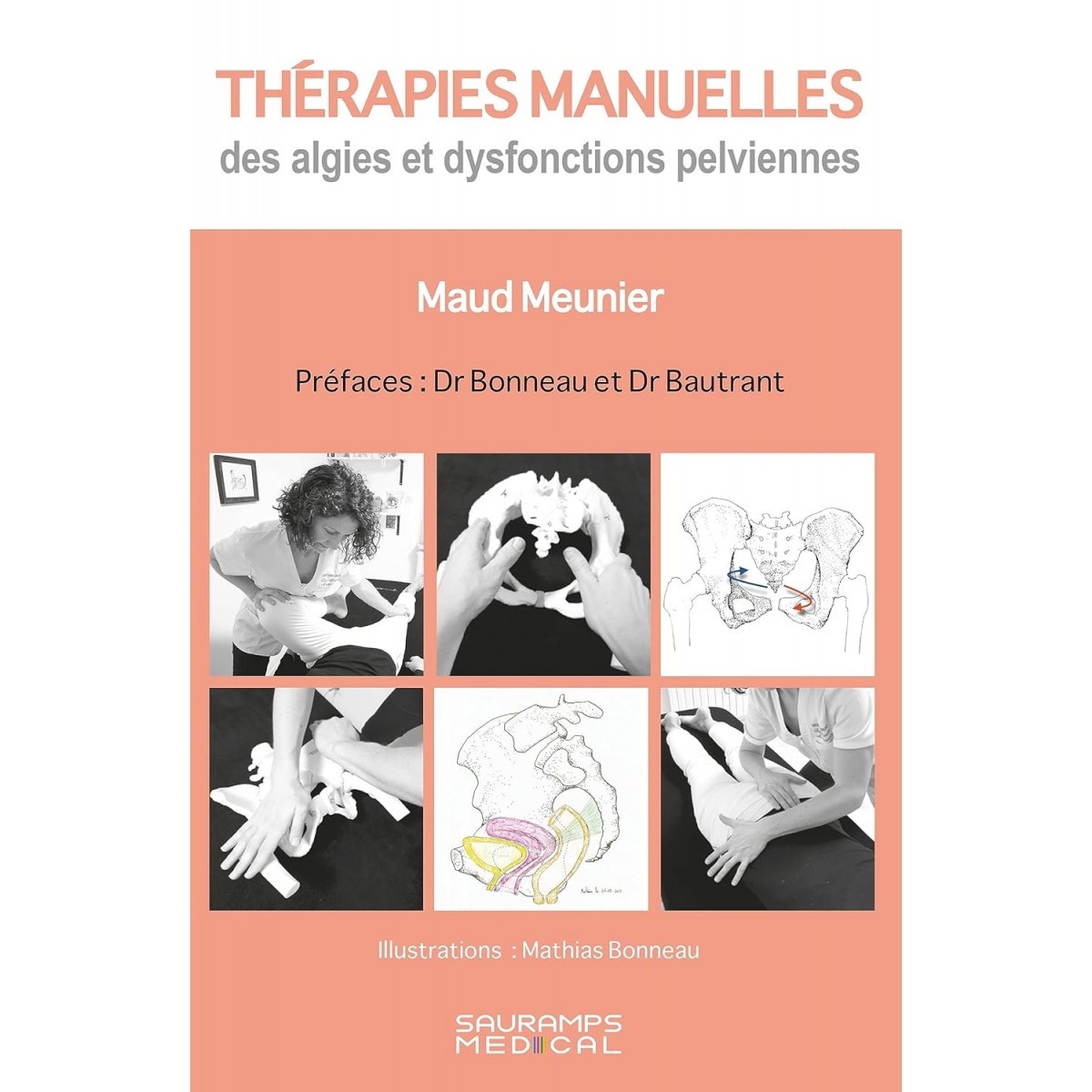 Thérapies manuelles des algies et dysfonctions pelviennes