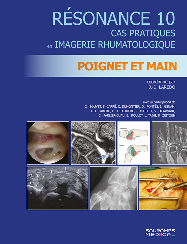 Résonance - Tome 10, Cas pratiques en imagerie rhumatologique : poignet et main