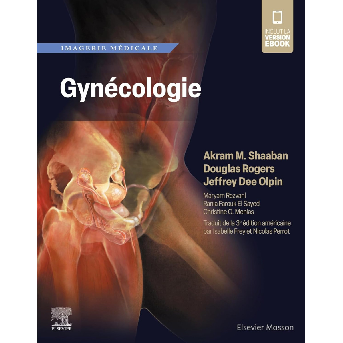Imagerie médicale : Gynécologie