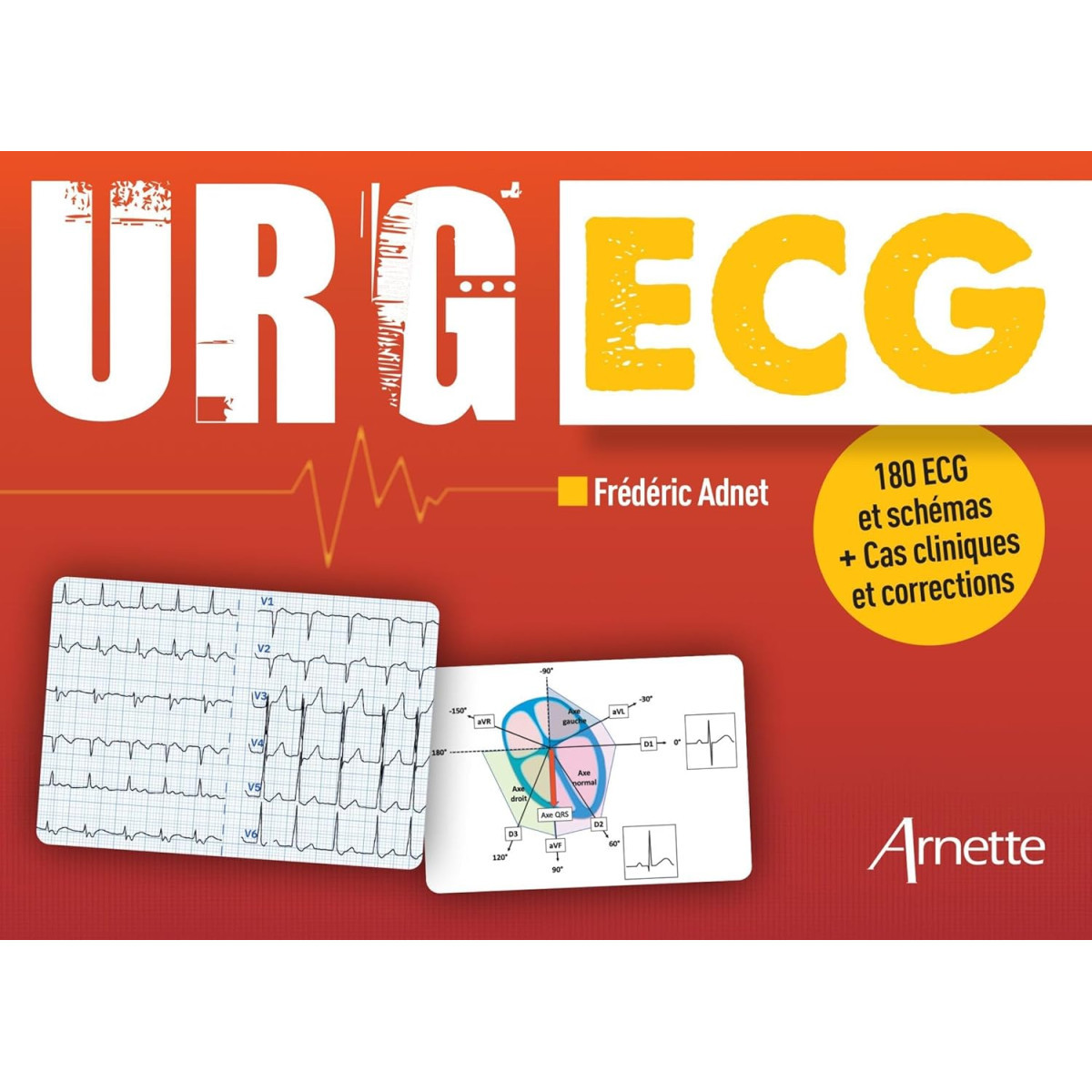 Urg' ECG en urgence - 180 ECG et schémas + Cas cliniques et corrections