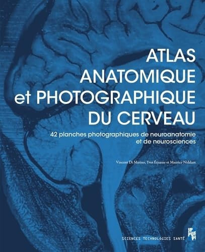 Atlas anatomique et photographique du cerveau