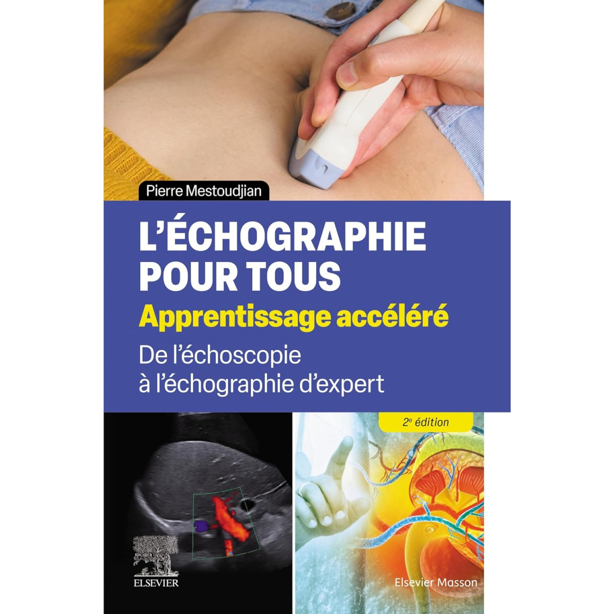 L'échographie pour tous : apprentissage accéléré - De l'échoscopie à l'échographie d'expert