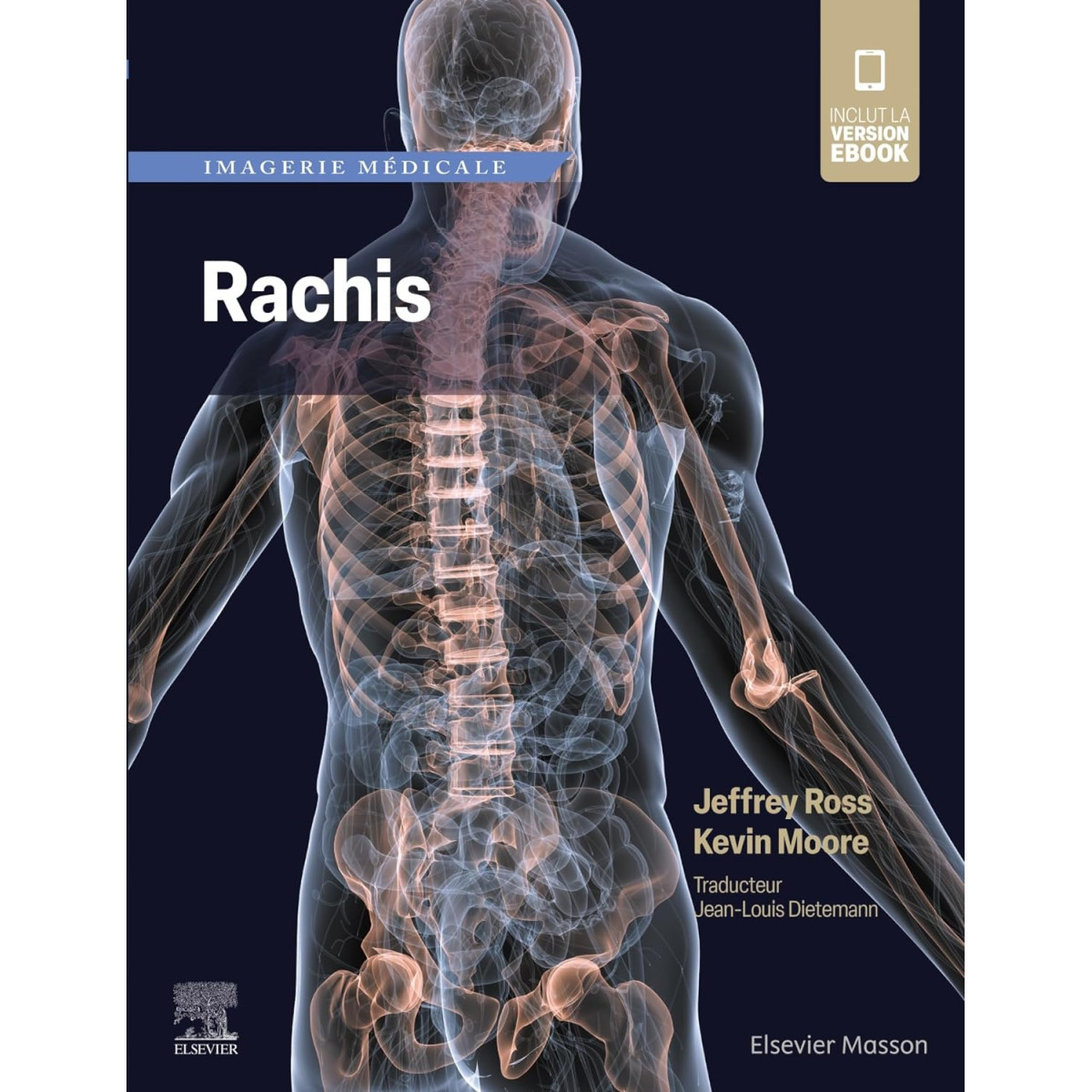 Imagerie médicale : Rachis
