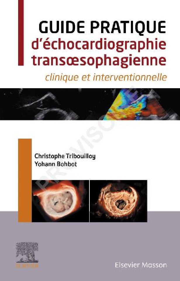 Guide pratique d'échocardiographie transoesophagienne: clinique et interventionnelle