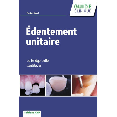 Edentement unitaire - Le...