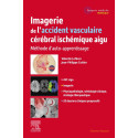 Imagerie de l\'accident vasculaire cérébral ischémique aigu - Méthode d\'auto-apprentissage
