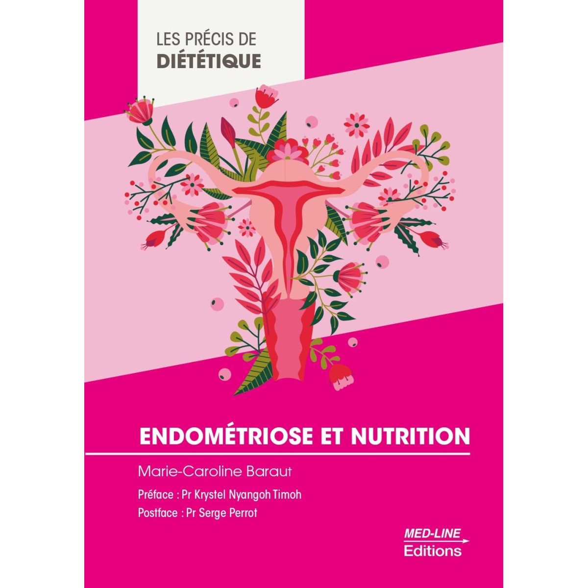 Endométriose et nutrition