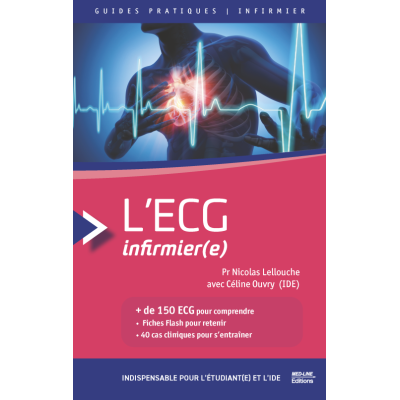 L'ECG infirmier(e)
