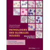 Pathologies des globules rouges - Glossaire illustré en 50 fiches