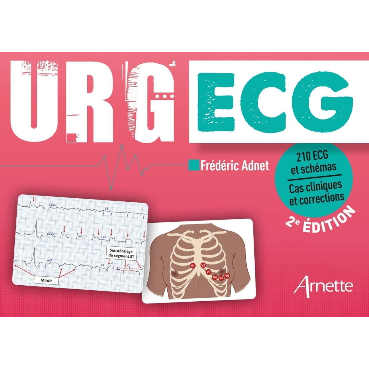 URG' ECG - 210 ECG et schémas - Cas cliniques et corrections