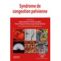 Syndrome de congestion pelvienne