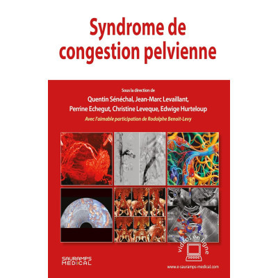 Syndrome de congestion...