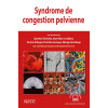 Syndrome de congestion pelvienne