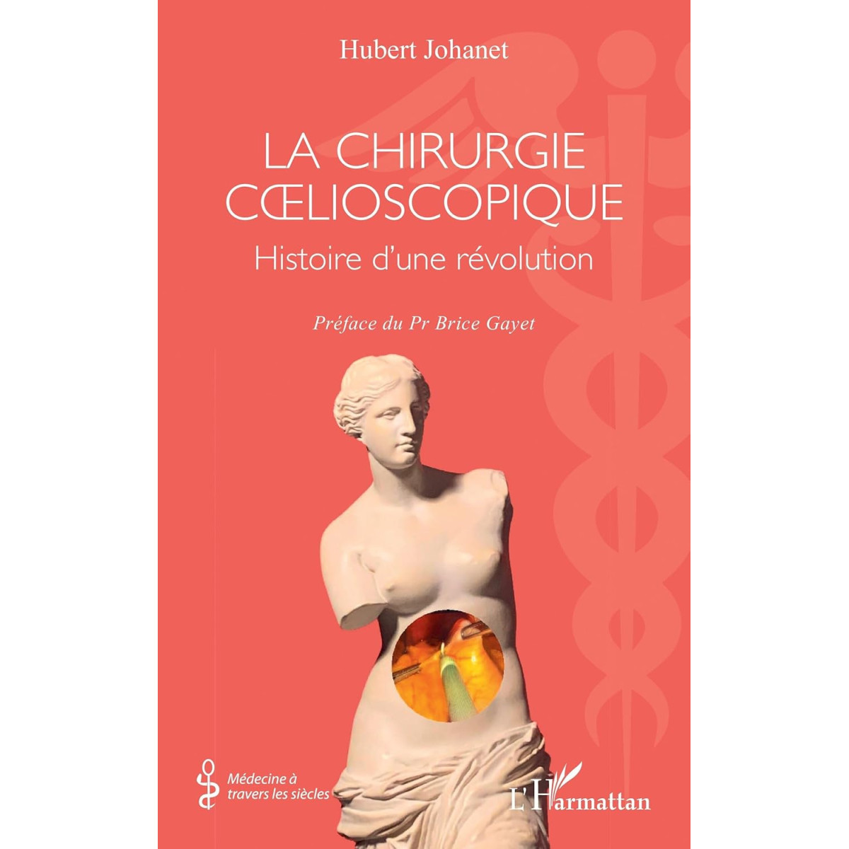 La Chirurgie cœlioscopique - Histoire d’une révolution