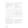 L'ECG de A à Z