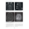 Neurologie