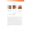 Tout-en-un de Proctologie