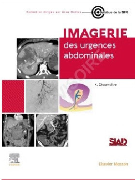 Imagerie des Urgences abdominales