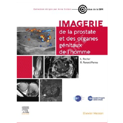 Imagerie de la prostate et...