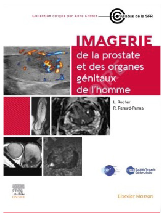 Imagerie de la prostate et des organes génitaux de l'homme