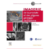 Imagerie de la prostate et des organes génitaux de l'homme