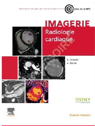 Radiologie cardiaque