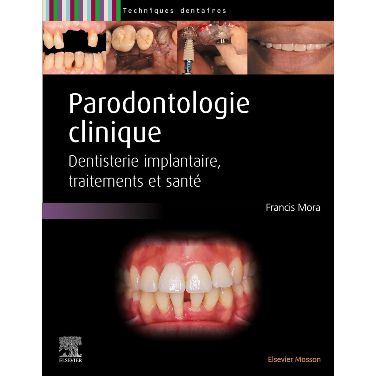 Parodontologie - Maladie parodontale, décision thérapeutique, traitements, Implantologie