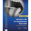 Lésions de la muqueuse buccale - Diagnostic différentiel