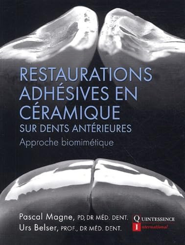 Restauration adhésives en céramique sur dents antérieures. Approche biométrique