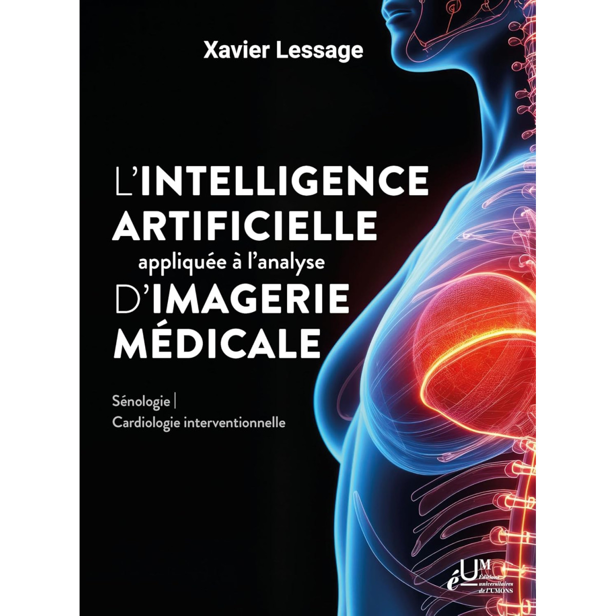 L’intelligence artificielle appliquée à l’analyse d’images médicales - Sénologie et Cardiologie interventionnelle