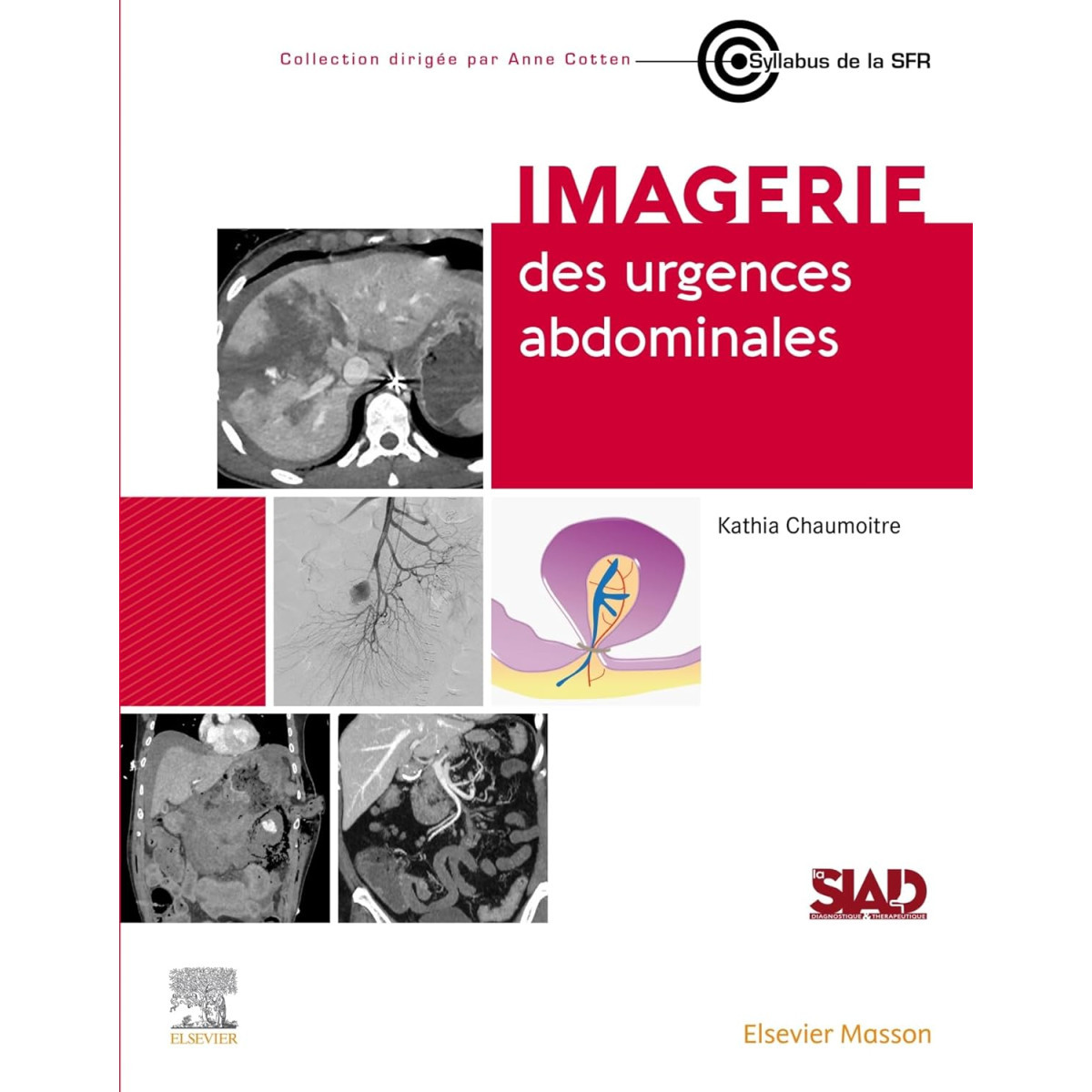 Imagerie des Urgences abdominales