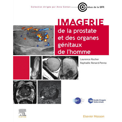 Imagerie de la prostate et...
