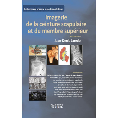 Imagerie de la ceinture...