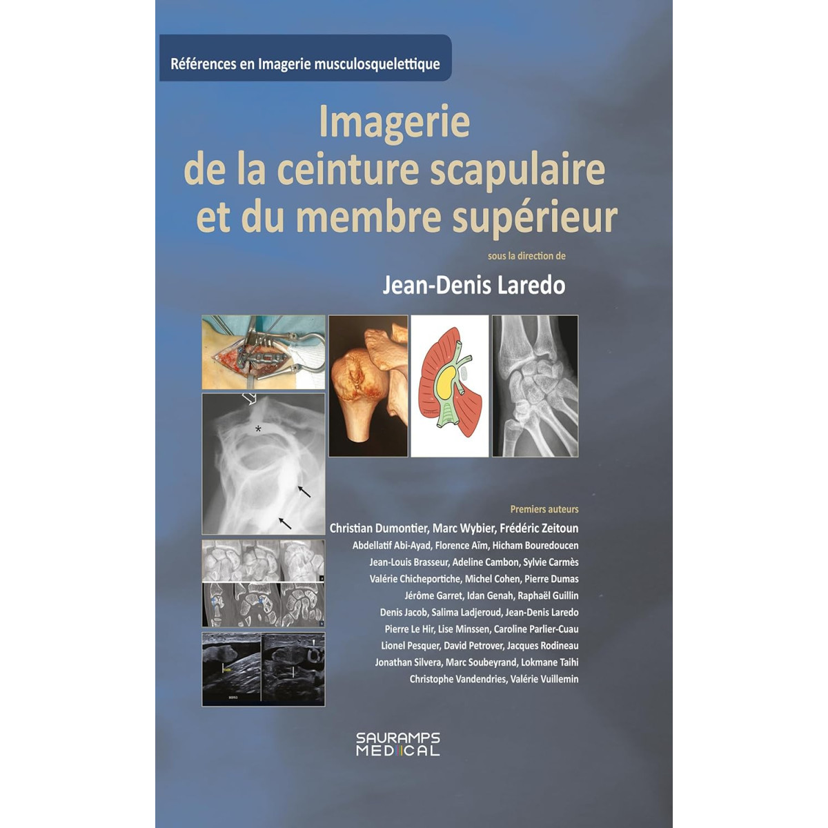Imagerie de la ceinture scrapulaire et du membre supérieur