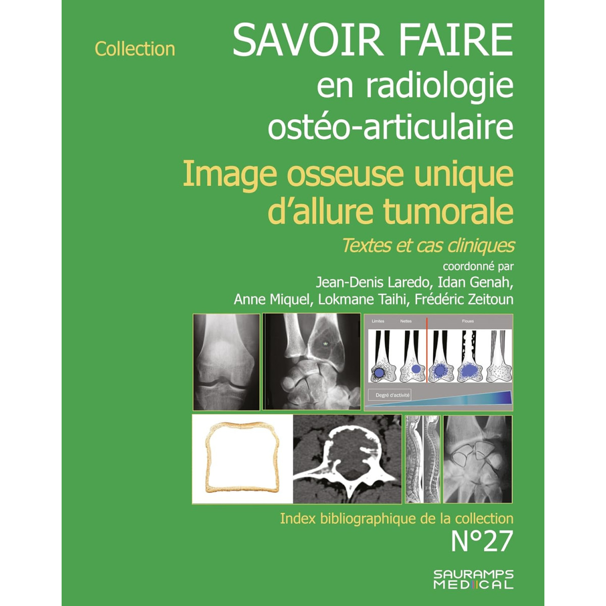 Image osseuse unique d'allure tumorale - Textes et cas cliniques