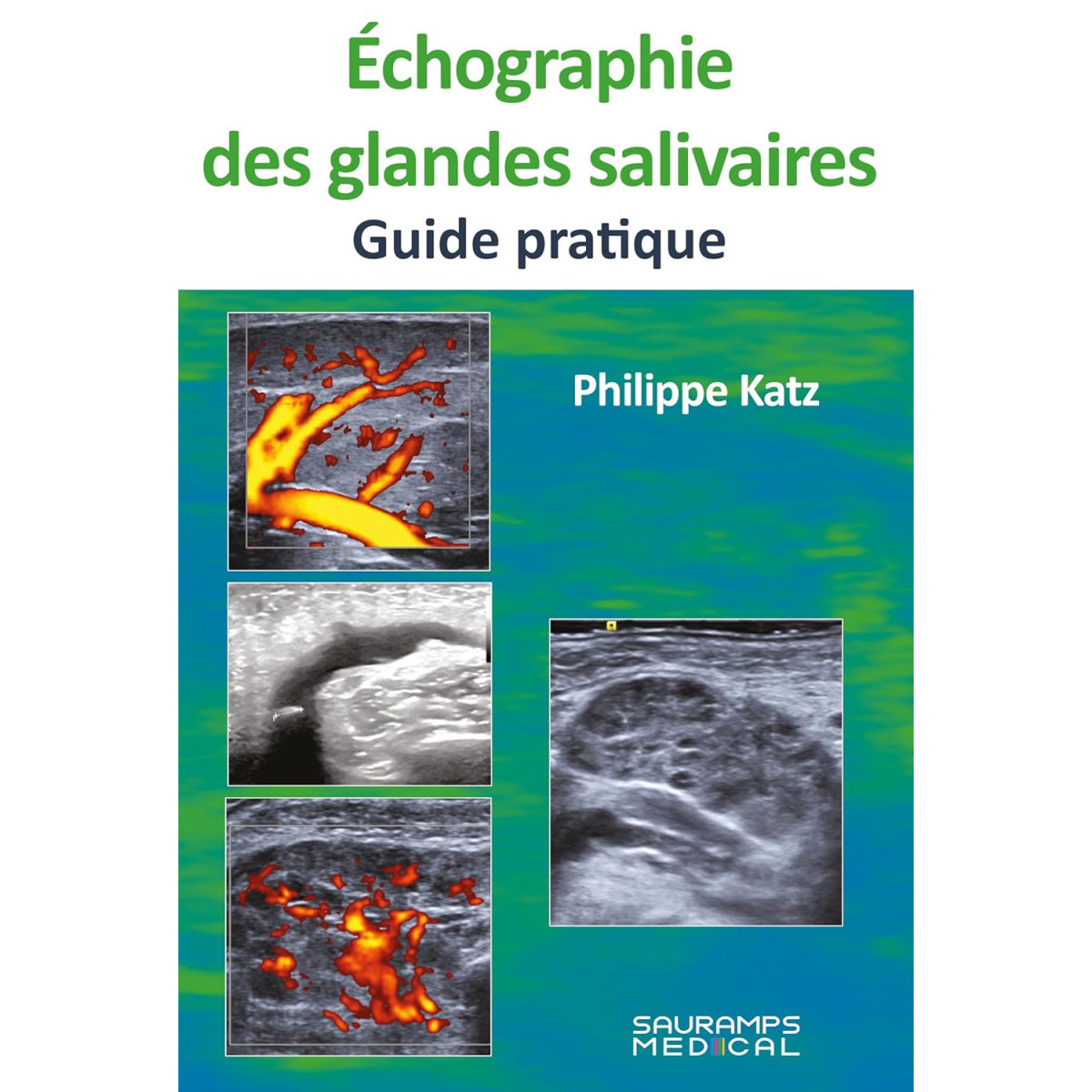 Échogragie des glandes salivaires - Guide pratique